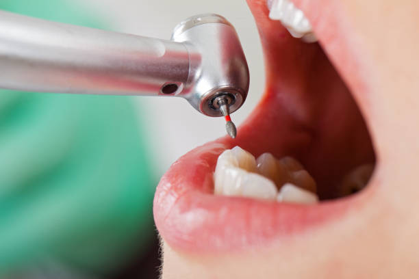 Best Cracked Tooth Emergency Dentist  in Central City, NE
